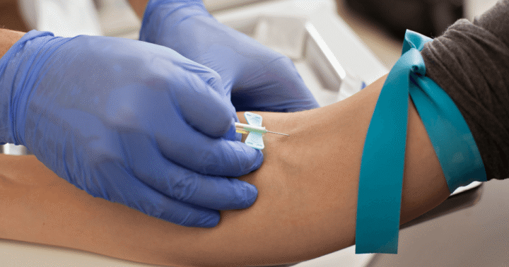 Magneesium vereanalüüs – veeniverest proovi võtmine laboratoorseks mõõtmiseks.